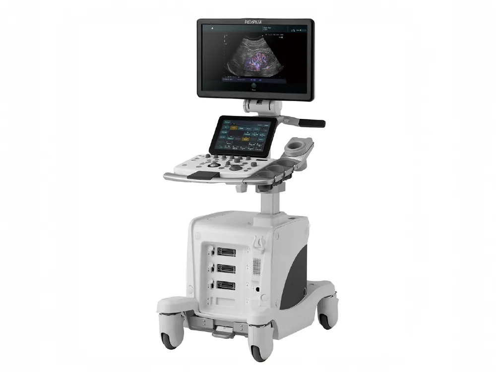 超音波診断装置